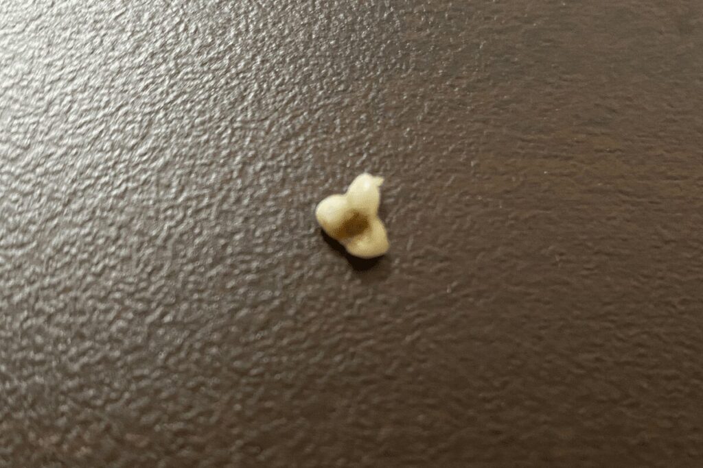 3歳になってから抜けた、柚餅子の乳歯