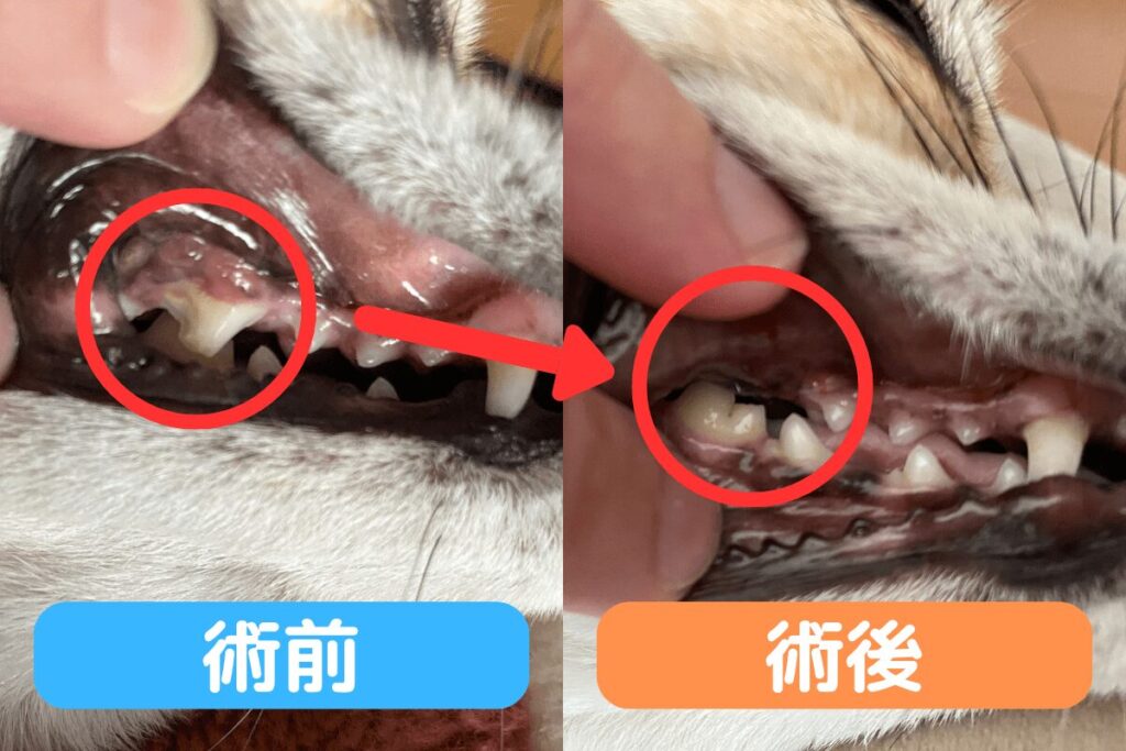 犬の歯の手術前と術後の比較（抜歯後の状態）